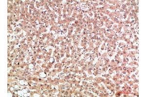 Immunohistochemical analysis of paraffin-embedded human-liver, antibody was diluted at 1:200 (EPG5 antibody  (AA 141-190))