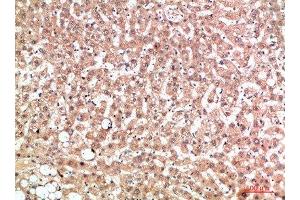 Immunohistochemical analysis of paraffin-embedded human-liver, antibody was diluted at 1:200
