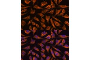 Immunofluorescence analysis of L929 cells using B3GNT4 antibody (ABIN7265875) at dilution of 1:100.