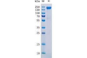 Human CD171 Protein, His Tag on SDS-PAGE under reducing condition. (L1CAM Protein (His tag))