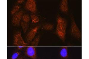Immunofluorescence analysis of U-2 OS cells using PLK1 Polyclonal Antibody at dilution of 1:100 (40x lens). (PLK1 antibody)