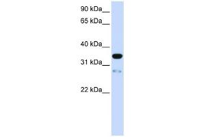TMEM38A antibody used at 1 ug/ml to detect target protein.