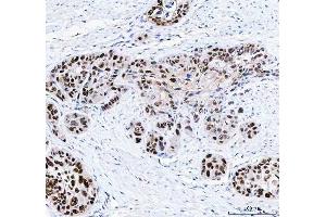 IHC analysis of FEN1 using anti-FEN1 antibody (ABIN7601617).