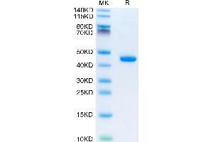 Mouse B2M on Tris-Bis PAGE under reduced condition. (beta-2 Microglobulin Protein (AA 21-119) (Fc Tag))