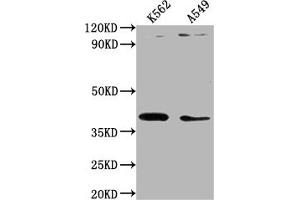 Western Blot Positive WB detected in: K562 whole cell lysate, A549 whole cell lysate All lanes: TMOD1 antibody at 1:1000 Secondary Goat polyclonal to rabbit IgG at 1/50000 dilution Predicted band size: 41, 27 kDa Observed band size: 41 kDa (Tropomodulin 1 antibody  (AA 105-359))