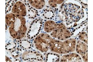 Image no. 18 for anti-EPM2A (Laforin) Interacting Protein 1 (EPM2AIP1) antibody (ABIN1498047) (EPM2AIP1 antibody)