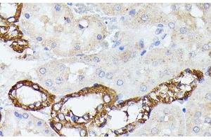 Immunohistochemistry of paraffin-embedded Rat kidney using LTF Polyclonal Antibody at dilution of 1:100 (40x lens). (Lactoferrin antibody)