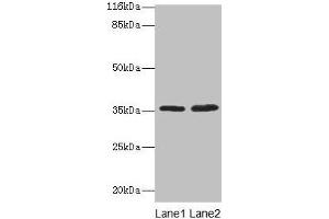Western blot All lanes: ACKR1 antibody at 2 μg/mL Lane 1: Mouse kidney tissue Lane 2: Mouse spleen tissue Secondary Goat polyclonal to rabbit IgG at 1/10000 dilution Predicted band size: 36 kDa Observed band size: 36 kDa