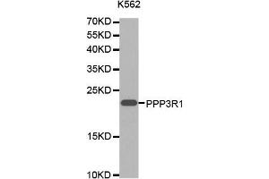 Western blot analysis of extracts of K-562 cells lines, using PPP3R1 antibody. (PPP3R1 antibody  (AA 11-170))