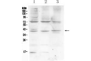 Western blot analysis of HFE using anti-HFE antibody . (HFE antibody  (AA 82-199))