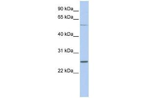 WB Suggested Anti-SCN1B Antibody Titration:  0. (SCN1B antibody  (Middle Region))