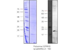 Western Blotting (WB) image for Protamine 2 (PRM2) (AA 2-102) protein (His tag) (ABIN3111844) (PRM2 Protein (AA 2-102) (His tag))