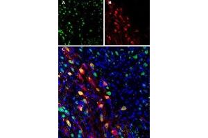 Expression of Ferroportin in mouse brain - Immunohistochemical staining of perfusion-fixed frozen mouse substantia nigra pars compacta (SNC) sections using Anti-Ferroportin (SLC40A1) Antibody (ABIN7043729, ABIN7044546 and ABIN7044547). (SLC40A1 antibody  (2nd Cytoplasmic Loop))