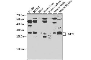Western blot analysis of extracts of various cell lines, using NFYB antibody (ABIN6128340, ABIN6144602, ABIN6144603 and ABIN6223127) at 1:500 dilution. (NFYB antibody  (AA 1-207))