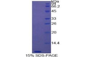 SDS-PAGE (SDS) image for Thymosin beta-4 (TMSB4X) (AA 1-44) protein (His tag) (ABIN1080921)