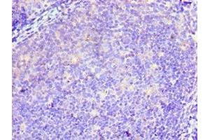 Immunohistochemistry of paraffin-embedded human tonsil tissue using ABIN7173940 at dilution of 1:100 (TWF2 antibody  (AA 1-349))