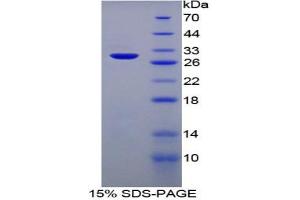 SDS-PAGE analysis of Rat Heparin Cofactor II Protein.