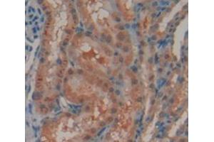 Immunohistochemistry (IHC) image for anti-Androgen Receptor (AR) (AA 491-679) antibody (ABIN1174429)