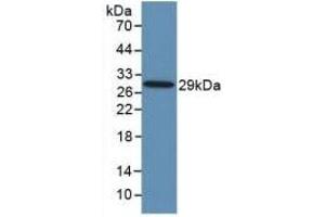Detection of Recombinant TLR8, Human using Monoclonal Antibody to Toll Like Receptor 8 (TLR8) (TLR8 antibody  (AA 844-1039))