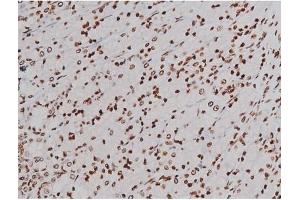 ABIN6256004 and ABIN6267365 at 1/200 staining Rat ganstric tissue sections by IHC-P. (KIT antibody  (pTyr721))