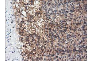 Immunohistochemical staining of paraffin-embedded Human breast tissue using anti-ADIPOQ mouse monoclonal antibody. (ADIPOQ antibody  (AA 19-244))