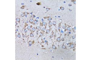Immunohistochemistry of paraffin-embedded mouse brain using IRAK4 antibody. (IRAK4 antibody)