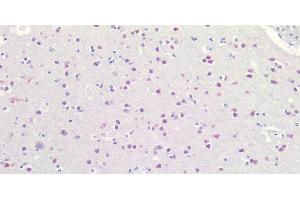 Immunohistochemistry of paraffin-embedded Human Brain using RBFOX3 Polyclonal Antibody at dilution of 1:100. (NeuN antibody)