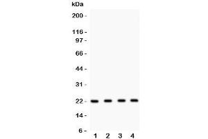 Western blot testing of Securin antibody and Lane 1:  HeLa;  2: MCF-7;  3: SKOV;  4: A375 lysate.