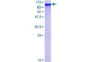 LRSAM1 Protein (AA 1-723) (GST tag)