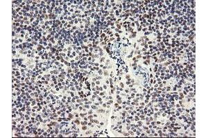 Image no. 4 for anti-SEC14 and Spectrin Domains 1 (SESTD1) antibody (ABIN1501066) (SESTD1 antibody)