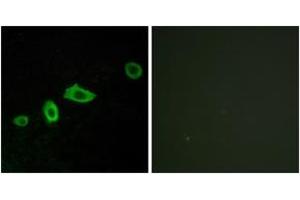 Immunofluorescence analysis of LOVO cells, using HTR5A Antibody. (Serotonin Receptor 5A antibody  (AA 15-64))