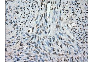 Image no. 3 for anti-Fc gamma RII (CD32) antibody (ABIN1497254) (Fc gamma RII (CD32) antibody)