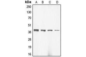 Western blot analysis of Alpha-actin-3 expression in DLD (A), HeLa (B), mouse brain (C), rat brain (D) whole cell lysates.