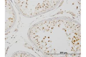 Immunoperoxidase of monoclonal antibody to IRAK4 on formalin-fixed paraffin-embedded human testis. (IRAK4 antibody  (AA 1-130))