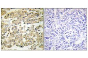 Immunohistochemistry (IHC) image for anti-14-3-3 zeta (YWHAZ) (pSer58) antibody (ABIN1847200) (14-3-3 zeta antibody  (pSer58))