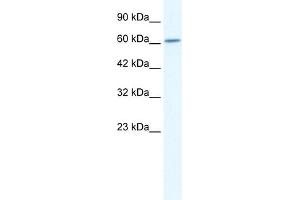 WB Suggested Anti-CUL5 Antibody Titration:  2. (Cullin 5 antibody  (C-Term))