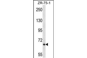 Western blot analysis in ZR-75-1 cell line lysates (35ug/lane). (Junctophilin 2 antibody  (C-Term))