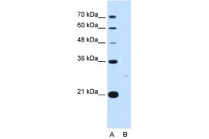 YWHAZ antibody used at 5 ug/ml to detect target protein.