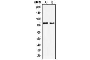 Western blot analysis of KAT7 expression in HepG2 (A), MCF7 (B) whole cell lysates. (MYST2 antibody  (Center))