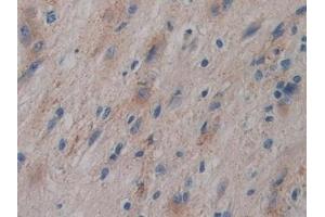 Immunohistochemistry (IHC) image for anti-Glycosylphosphatidylinositol Specific phospholipase D1 (GPLD1) (AA 496-840) antibody (ABIN7436591)
