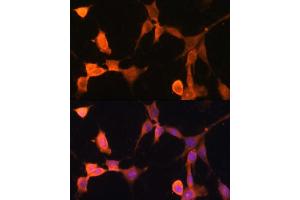 Immunofluorescence analysis of NIH-3T3 cells using CACYBP antibody  at dilution of 1:100. (CACYBP antibody  (AA 1-228))