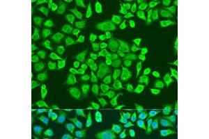 Immunofluorescence analysis of U2OS cells using IGF2BP3 Polyclonal Antibody at dilution of 1:100. (IGF2BP3 antibody)