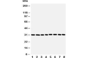 Western blot testing of VDAC1 antibody and Lane 1:  rat skeletal muscle;  2: (r) heart;  3: (r) liver; and human samples 4: HeLa;  5: A431;  6: A549;  7: SMMC-7721;  8: HT1080 cell lysate. (VDAC1 antibody  (Middle Region))
