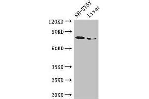 Western Blot Positive WB detected in: SH-SY5Y whole cell lysate, Mouse liver tissue All lanes: CHAT antibody at 3 μg/mL Secondary Goat polyclonal to rabbit IgG at 1/50000 dilution Predicted band size: 83, 75, 71 kDa Observed band size: 75 kDa (Choline Acetyltransferase antibody  (AA 354-592))