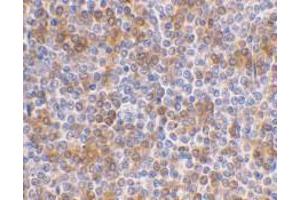 Immunohistochemical staining of human spleen using AP30069PU-N APOBEC3G antibody at 1 μg/ml.