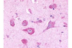 Immunohistochemical staining of Brain (Neurons) using anti- LPHN3 antibody ABIN122280 (LPHN3 antibody  (Cytoplasmic Domain))