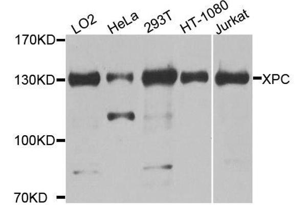 XPC antibody  (AA 700-940)
