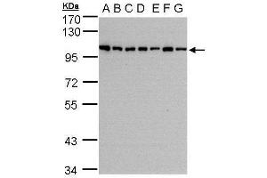WB Image Sample(30 μg of whole cell lysate) A:293T B:A431 , C:H1299 D:HeLa S3 , E:Hep G2 , F:MOLT4 , G:Raji , 7. (HPS3 antibody  (C-Term))