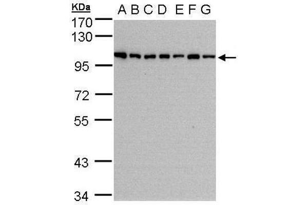 HPS3 Antikörper  (C-Term)