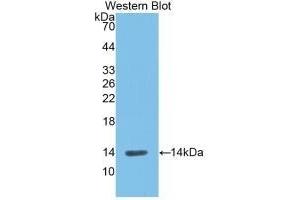 Detection of Recombinant REN, Rat using Monoclonal Antibody to Renin (REN) (Renin antibody  (AA 275-389))